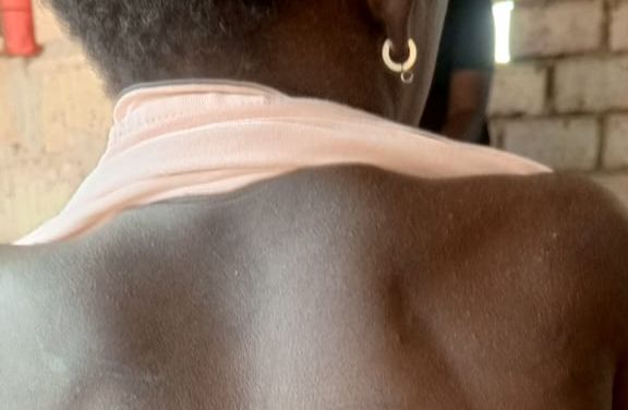 Bissorã: Diretora de escola pública é detida por maus-tratos à sobrinha